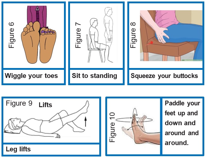 dvt prevention exercise NHS